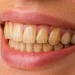 Factores determinantes en la coloración amarillenta de las piezas dentales