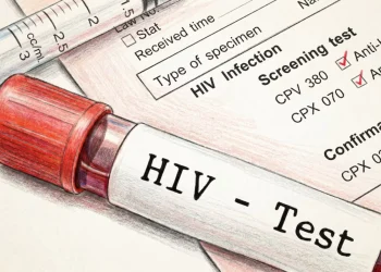 Alerta sanitaria: el 30% de los nuevos diagnósticos de vih se registra en personas que nunca se habían testeado