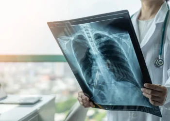 Alerta por virus respiratorios: el aumento de casos de VSR impacta en las notificaciones de neumonía y bronquiolitis