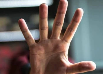 Violencia y robo en Capital: persiguió a su ex, la tiró al piso para asaltarla y terminó detenido tras agredir a la Policía