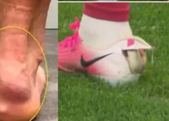Causa furor en el Mundial: el curioso motivo por el que la figura portuguesa Pedro Neto juega con un botín roto