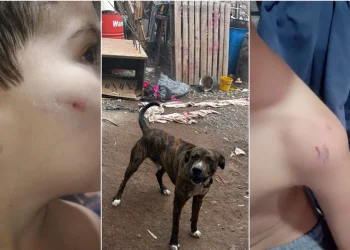 Pánico en Rawson: un perro cruza con pitbull atacó brutalmente a un nene de 3 años