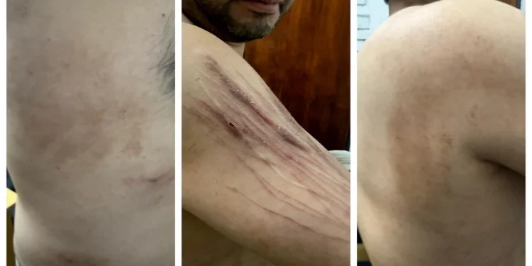 Investigan a penitenciarios por una presunta golpiza al sicario del empresario González y hay polémica por el fallo de un juez