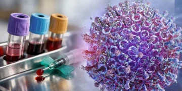 Alerta sanitaria mundial: confirman el primer caso histórico de contagio en humanos del virus Shamonda tras el fallecimiento de un paciente en Lyon