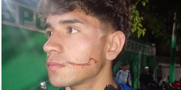 Ataque salvaje y detención: apedrearon el colectivo de Unión de Villa Krause, hirieron a dos futbolistas y Desamparados avanzó en semifinales