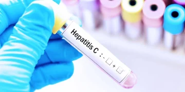 Alerta sanitaria por una infección silenciosa: Argentina registra hasta 800 casos anuales de Hepatitis C y piden testearse al menos una vez en la vida
