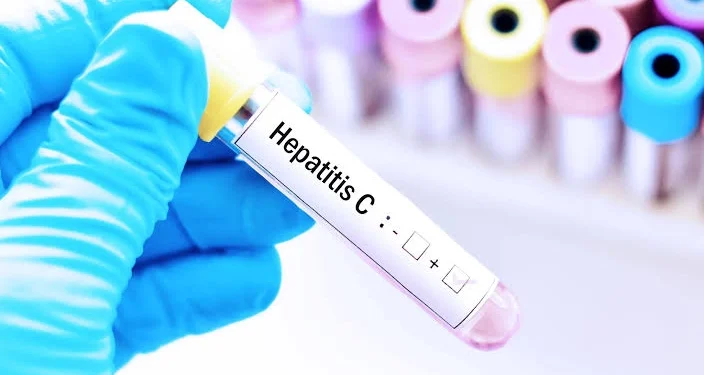 Alerta sanitaria por una infección silenciosa: Argentina registra hasta 800 casos anuales de Hepatitis C y piden testearse al menos una vez en la vida