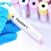 Alerta sanitaria por una infección silenciosa: Argentina registra hasta 800 casos anuales de Hepatitis C y piden testearse al menos una vez en la vida